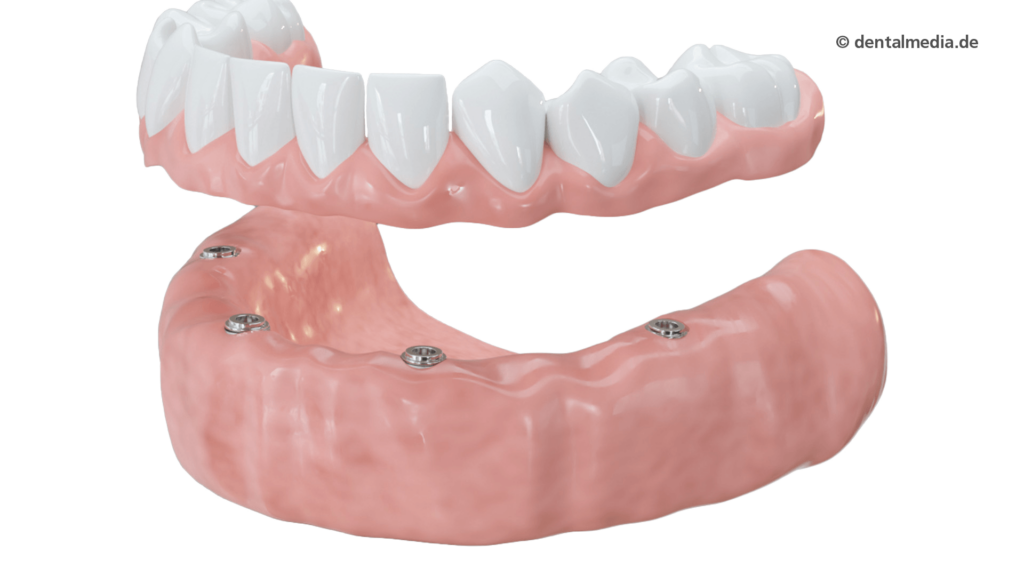 Dentallabor Werner — Zahnprothesen aus Geldern